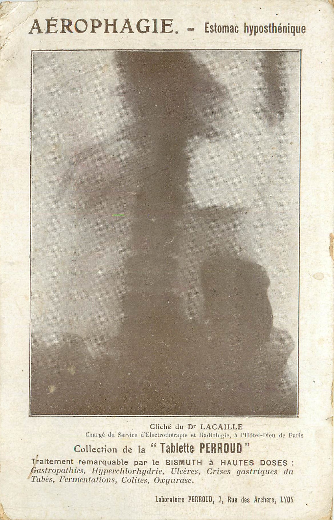 CPM Aerophagie Estomac Hyposthenique Tablette Perroud Pansement