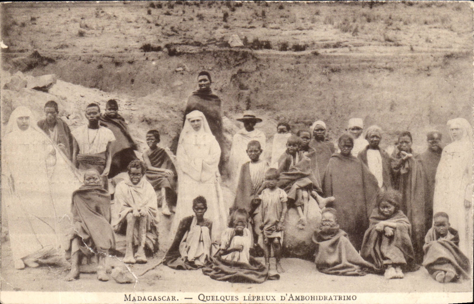 Madagascar Malagasy CPA Some leprous of Ambohidratrimo