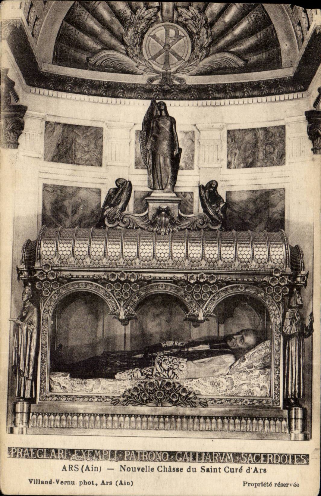 CPA Ars Nouvelle drives out Saint Cure of Arc