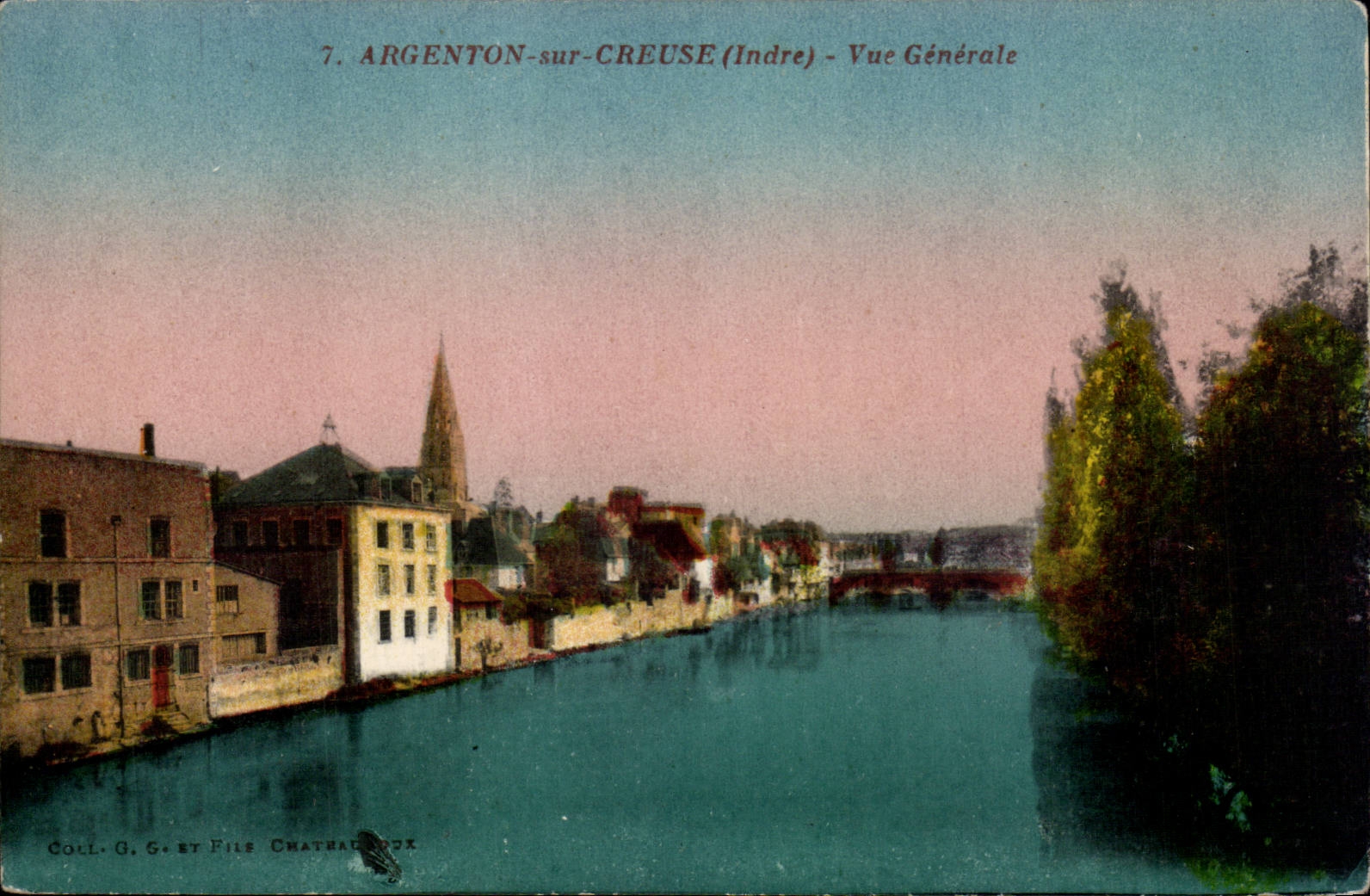 Plata de niquel de CPA en la vision hueco