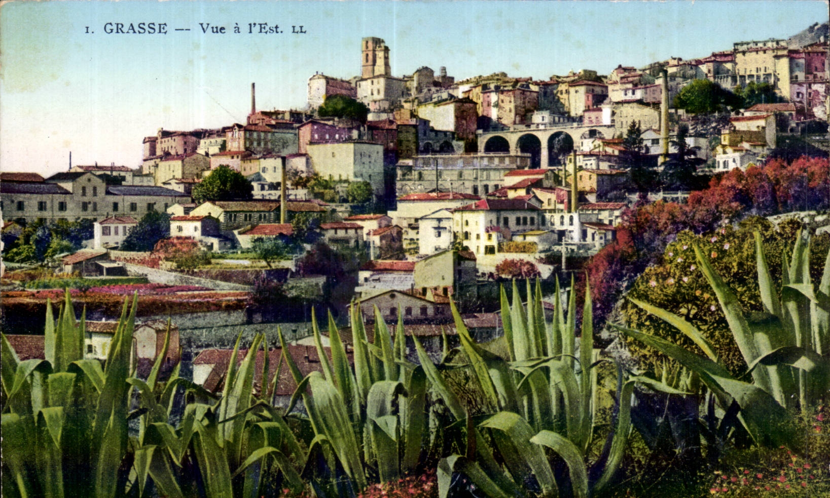 - La vista tiene es - CPA graso