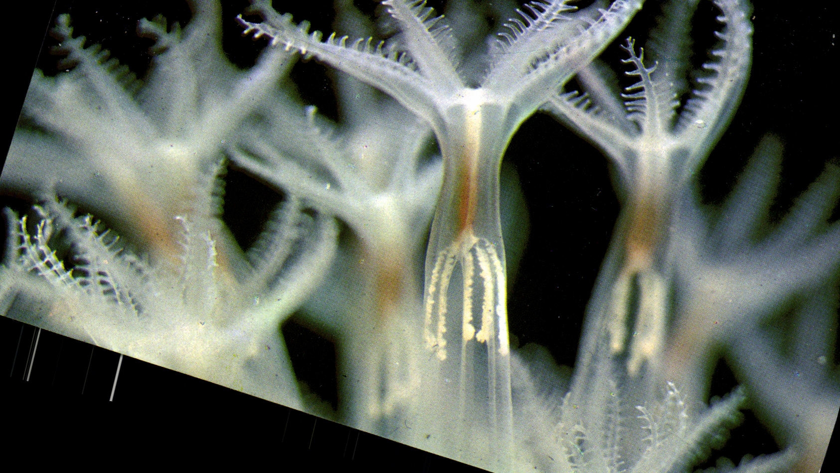 CPM Saint Malo Veretille Polypes