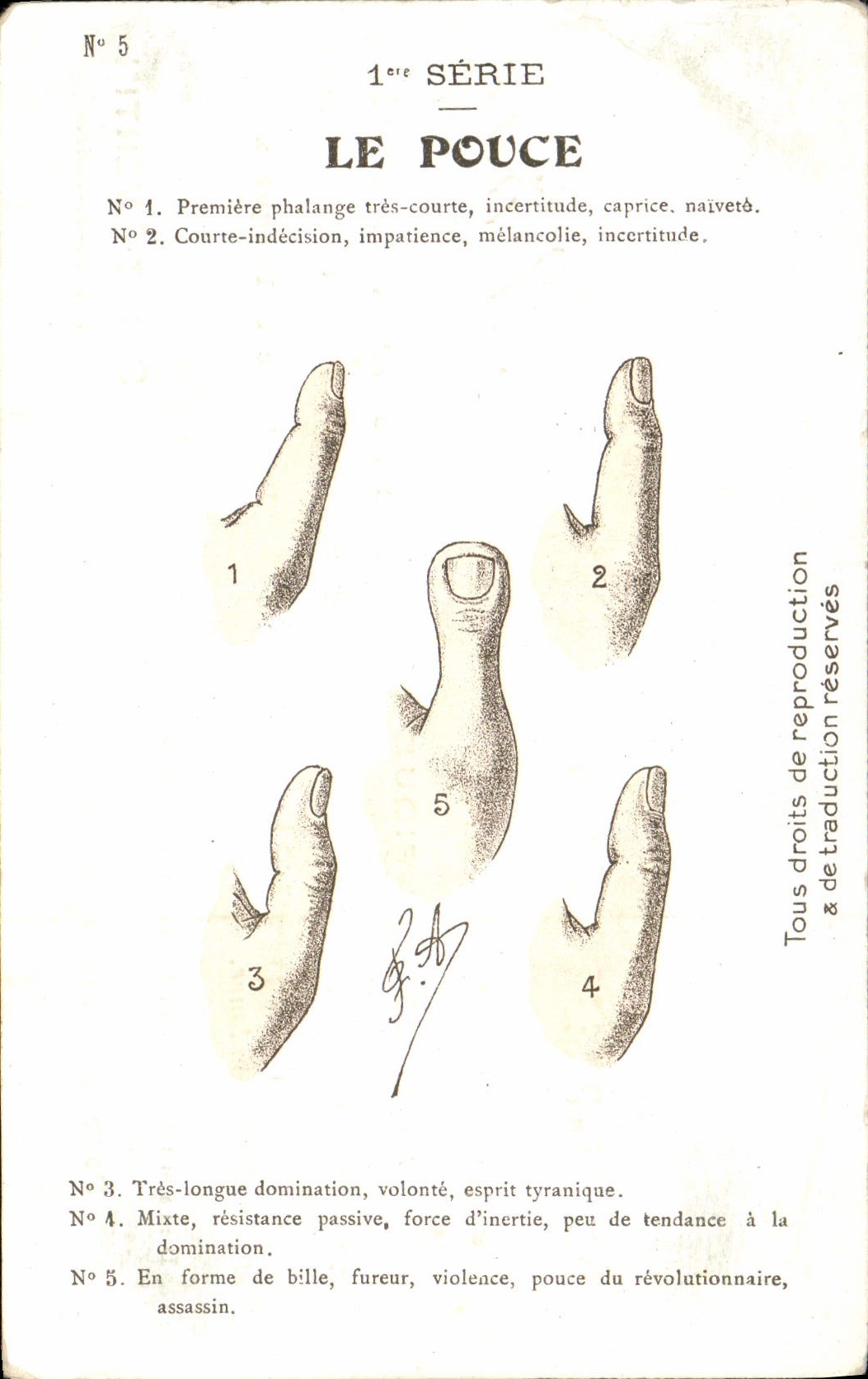 CPA Serie Le Pouce Premiere Phalange Tres Courte