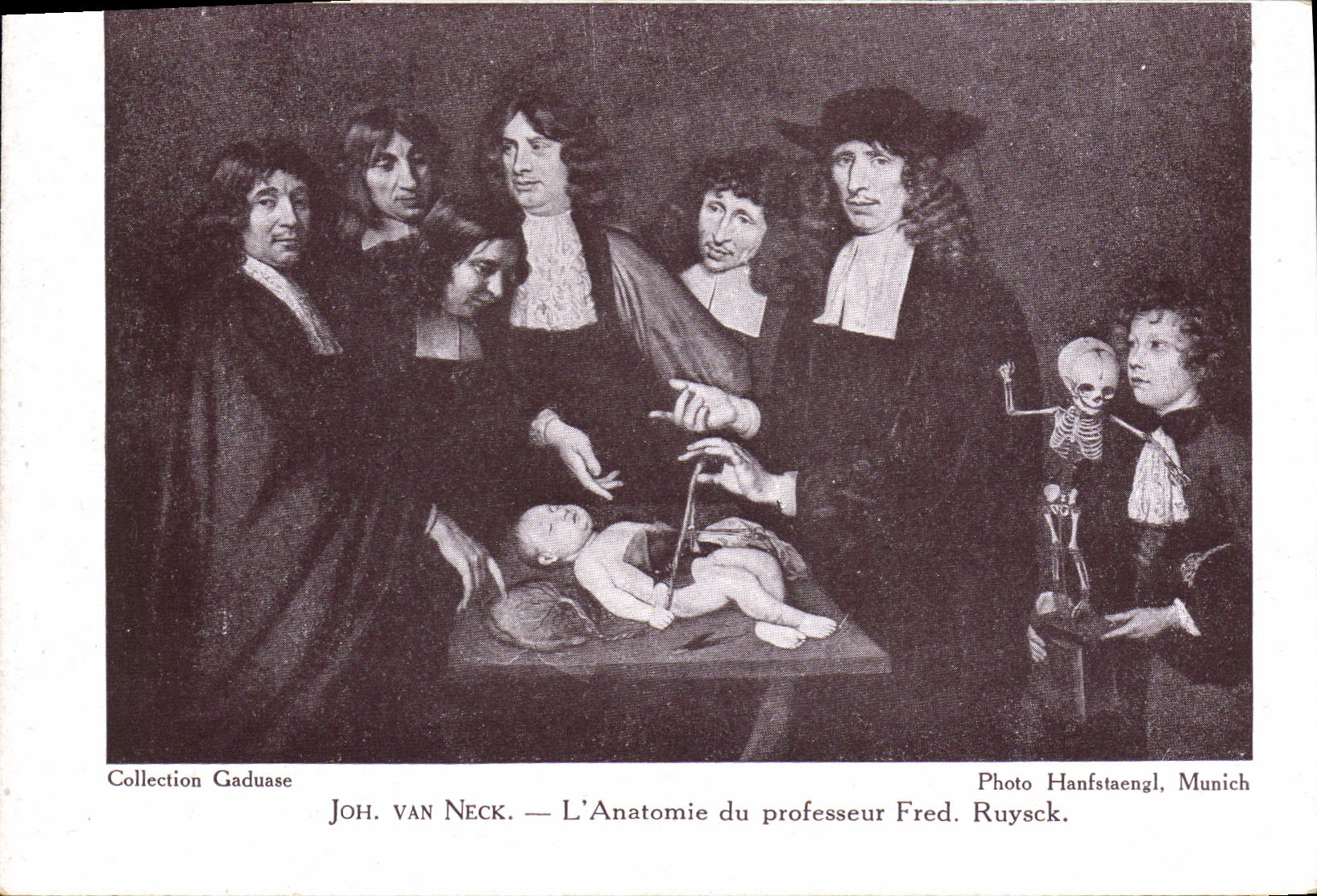 CPA Joh Van Neck L'anatomie du professeur Fred Ruysck Chrirurgie 