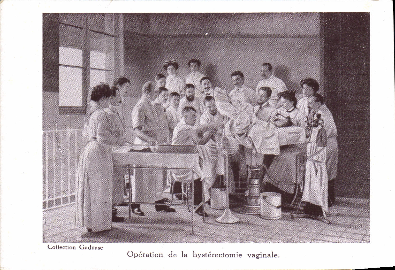 CPA Sante Operation de la hysterectomie vaginale