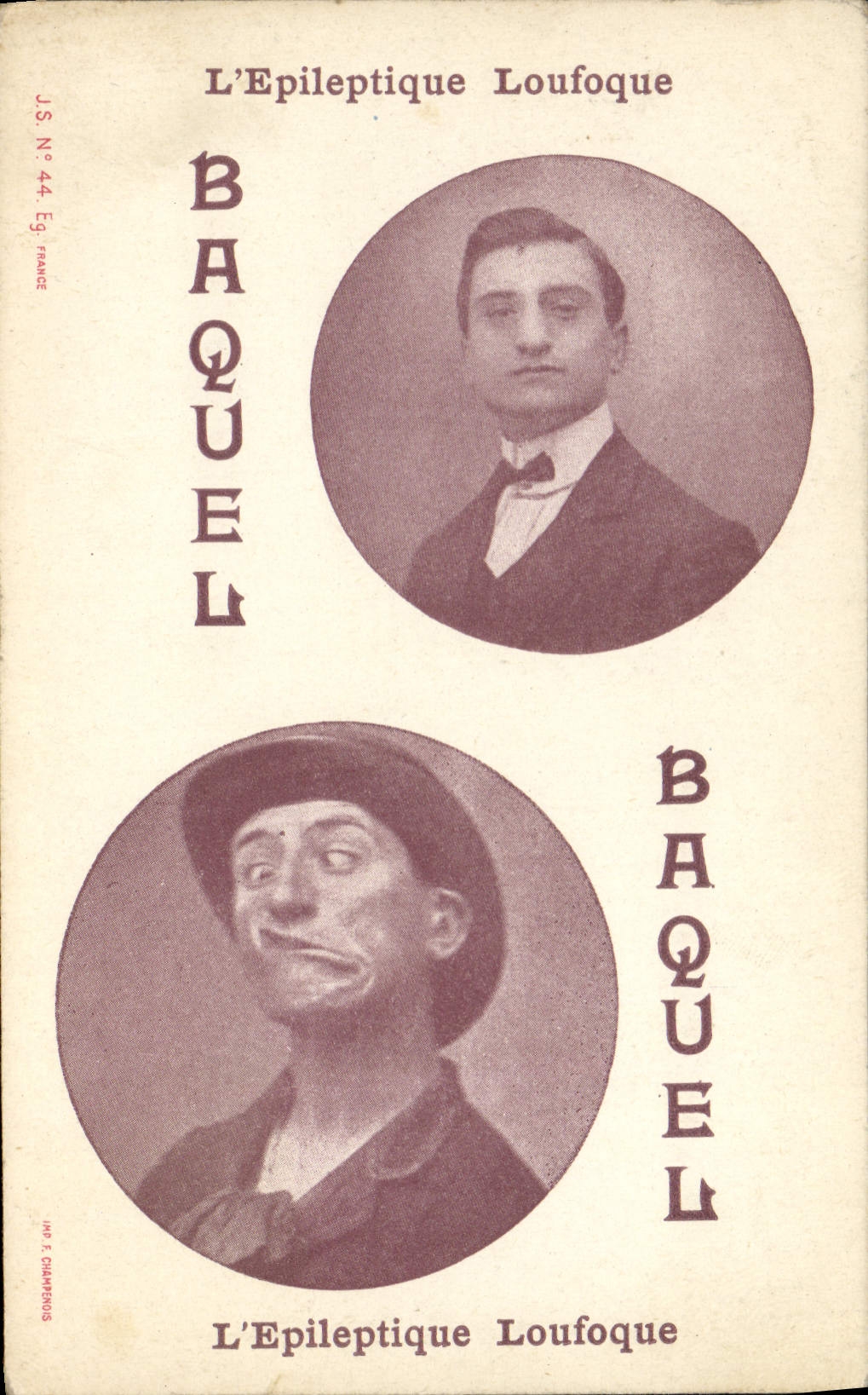 CPA L'epileptique Loufoque Baquel 