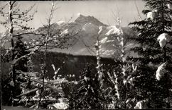 CPSM teeth of midday