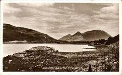 CPA Log leven and Pop the off Plencoe