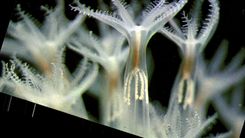 CPM Saint Malo Veretille Polypes